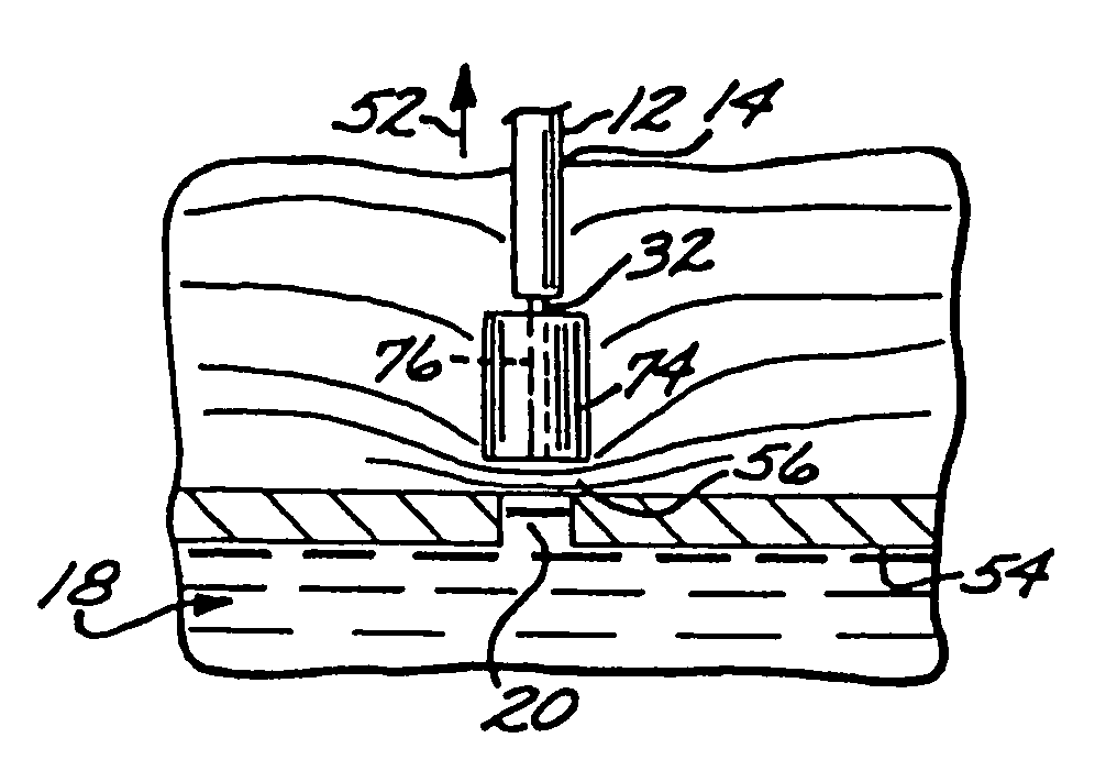 Apparatus and method for percutaneous sealing of blood vessel punctures