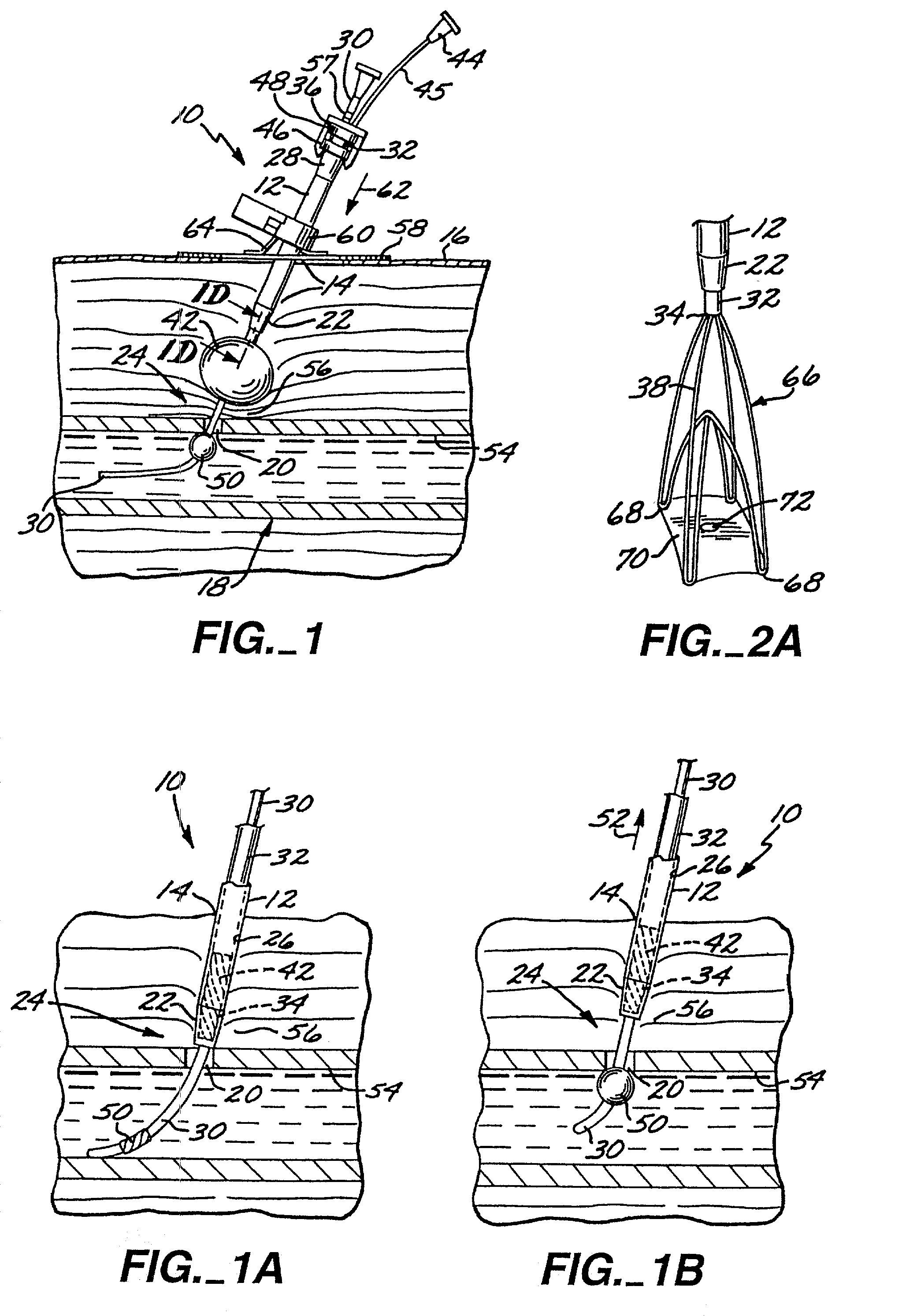 Apparatus and method for percutaneous sealing of blood vessel punctures