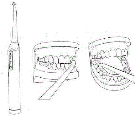 Overall cleaning equipment for oral cavity and application method of overall cleaning equipment