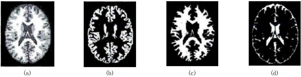 Brain part MRI image segmentation method