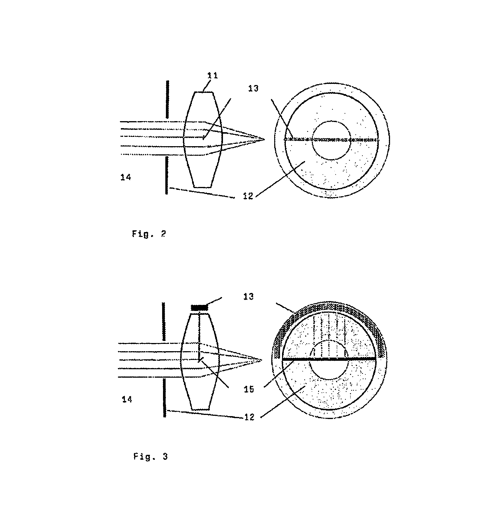 Implantable system for determining the accommodation requirement by optical measurement of the pupil diameter and the surrounding luminance