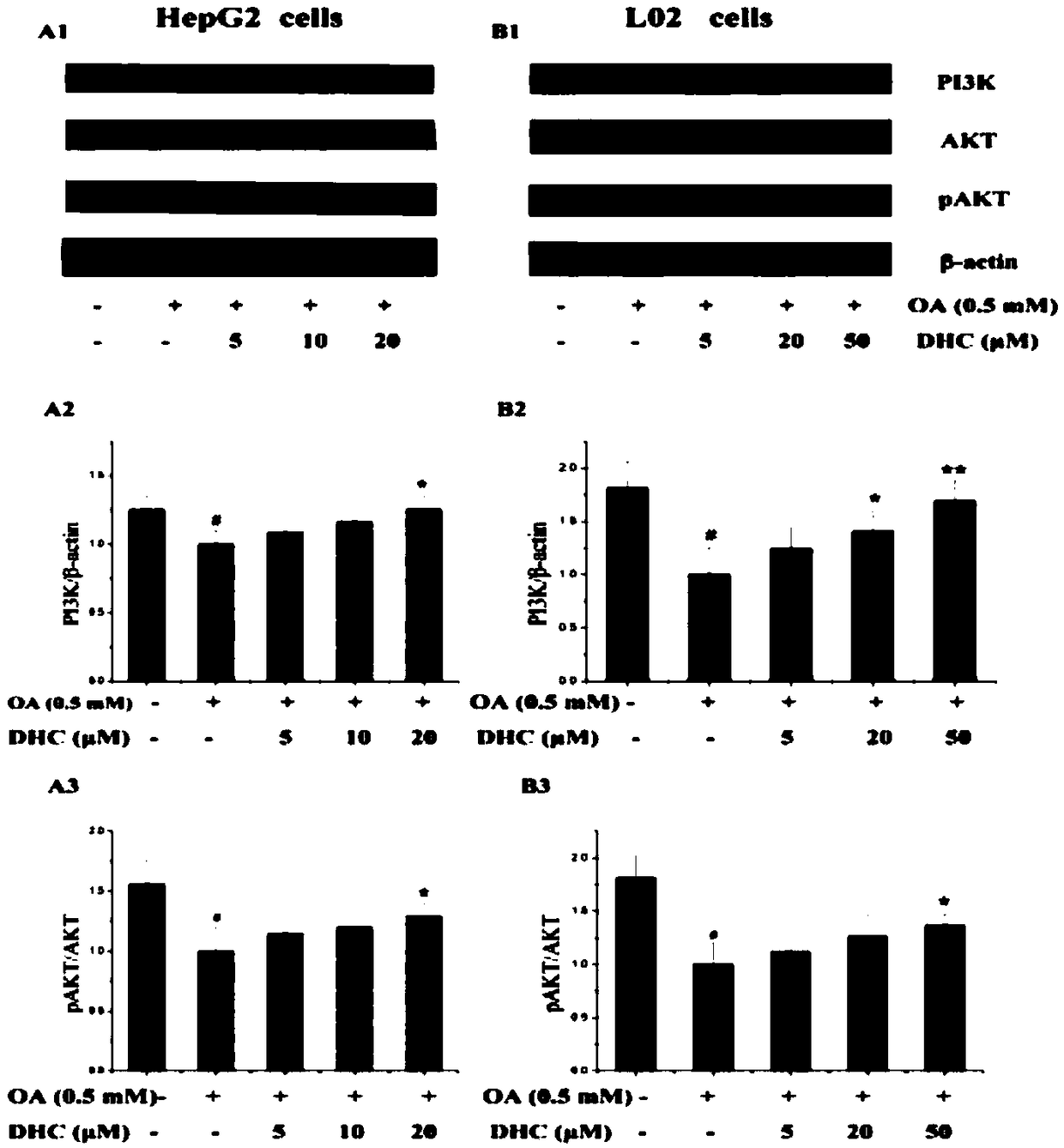 Application of dihydrocurcumin in the preparation of medicine for treating non-alcoholic fatty liver diseases