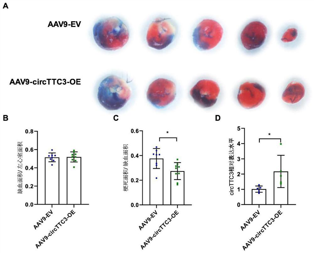 Circular RNA circTTC3 overexpression adeno-associated virus vector, adeno-associated virus and application of adeno-associated virus