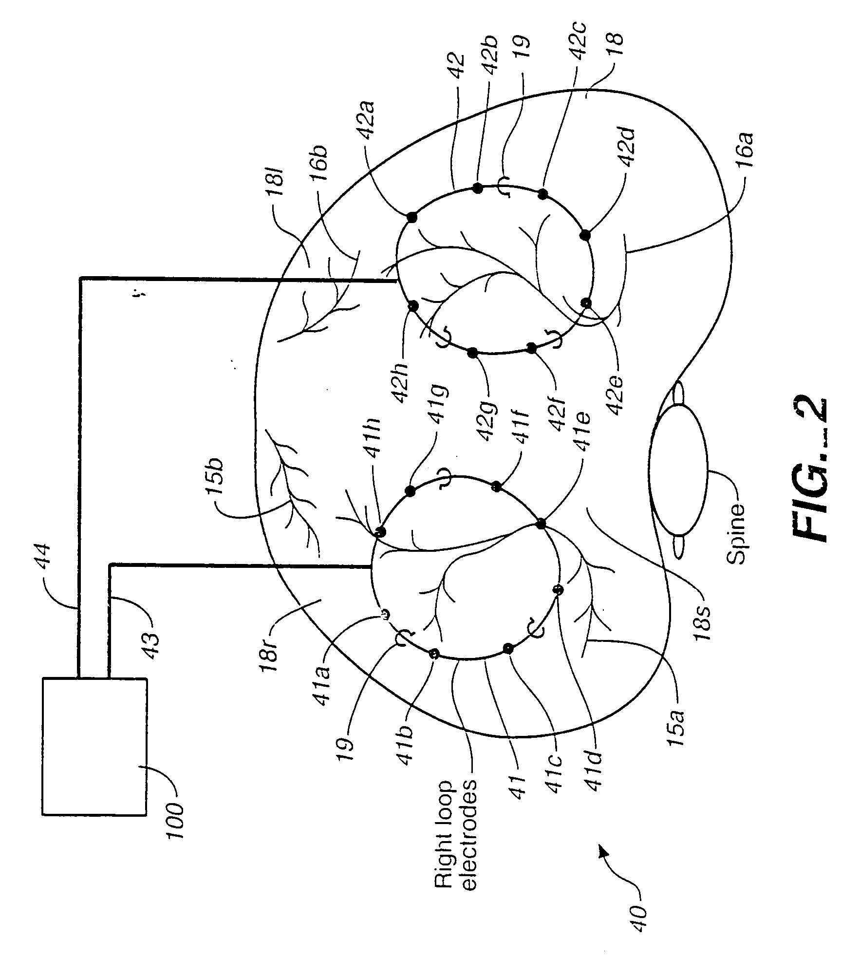 Patient compliance management device and method