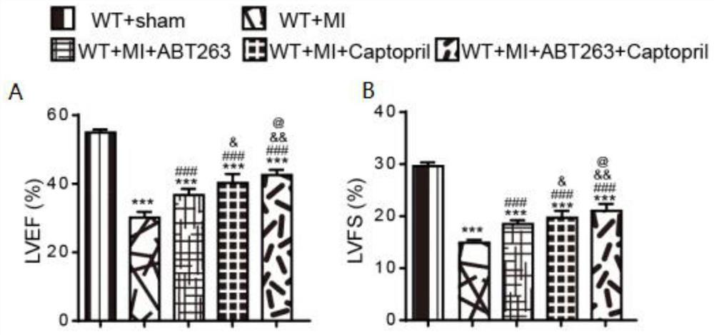 Application of abt-263 combined with angiotensin-converting enzyme inhibitors and its products