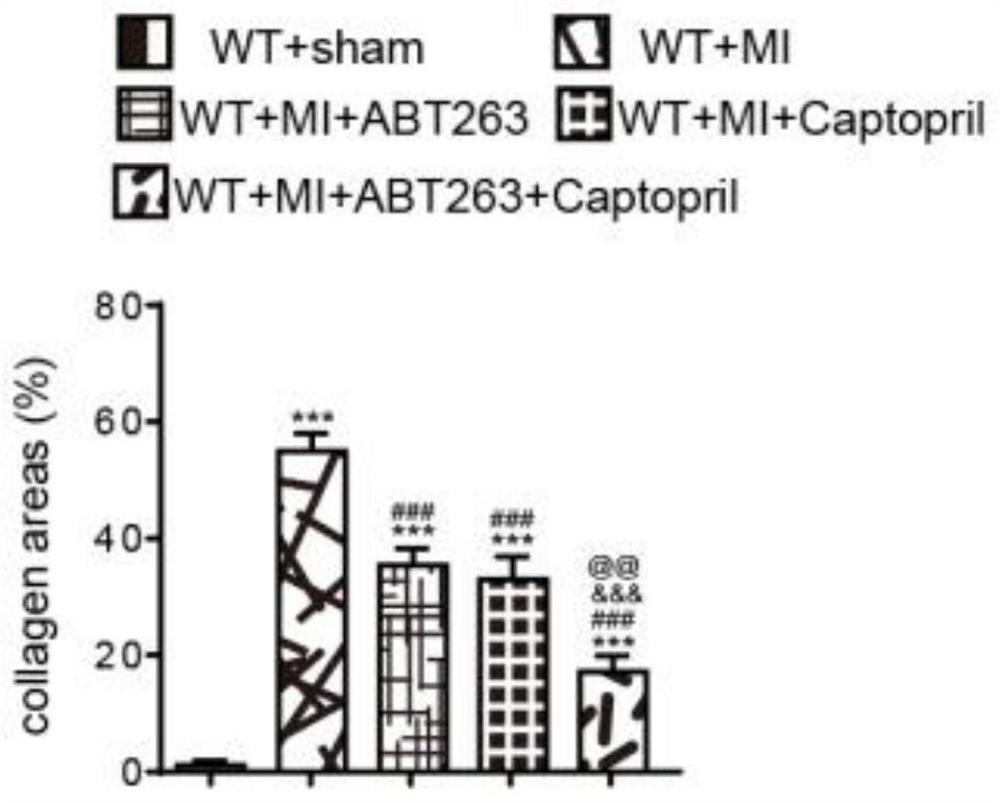 Application of abt-263 combined with angiotensin-converting enzyme inhibitors and its products