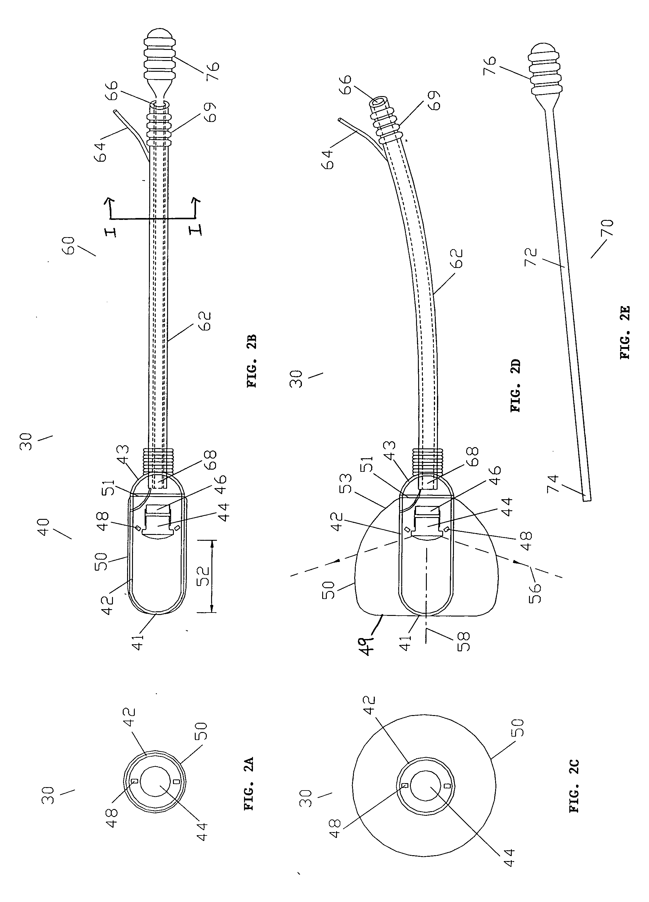Cervix monitoring system and related devices and methods