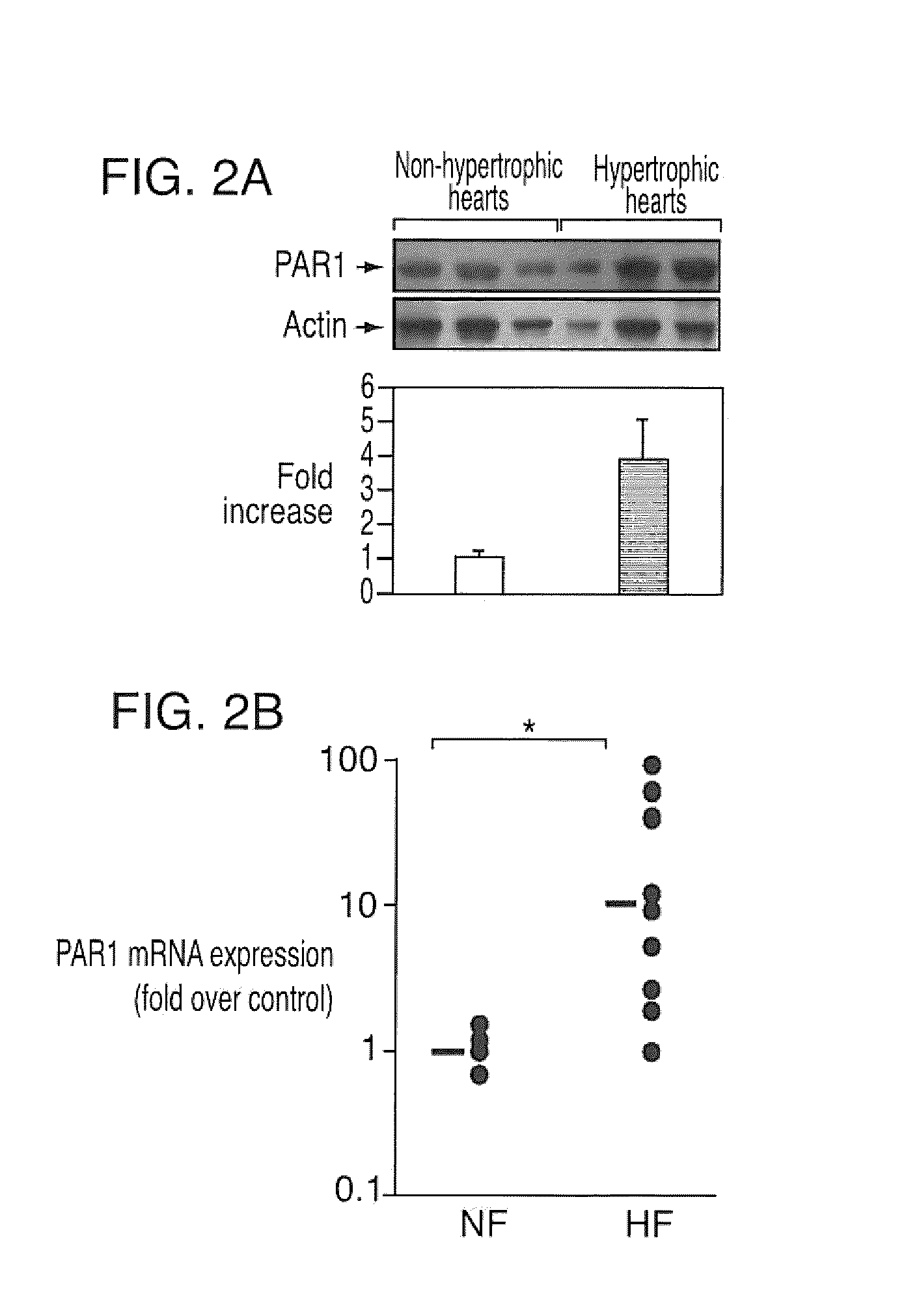 Methods and compositions for treating cardiac dysfunctions