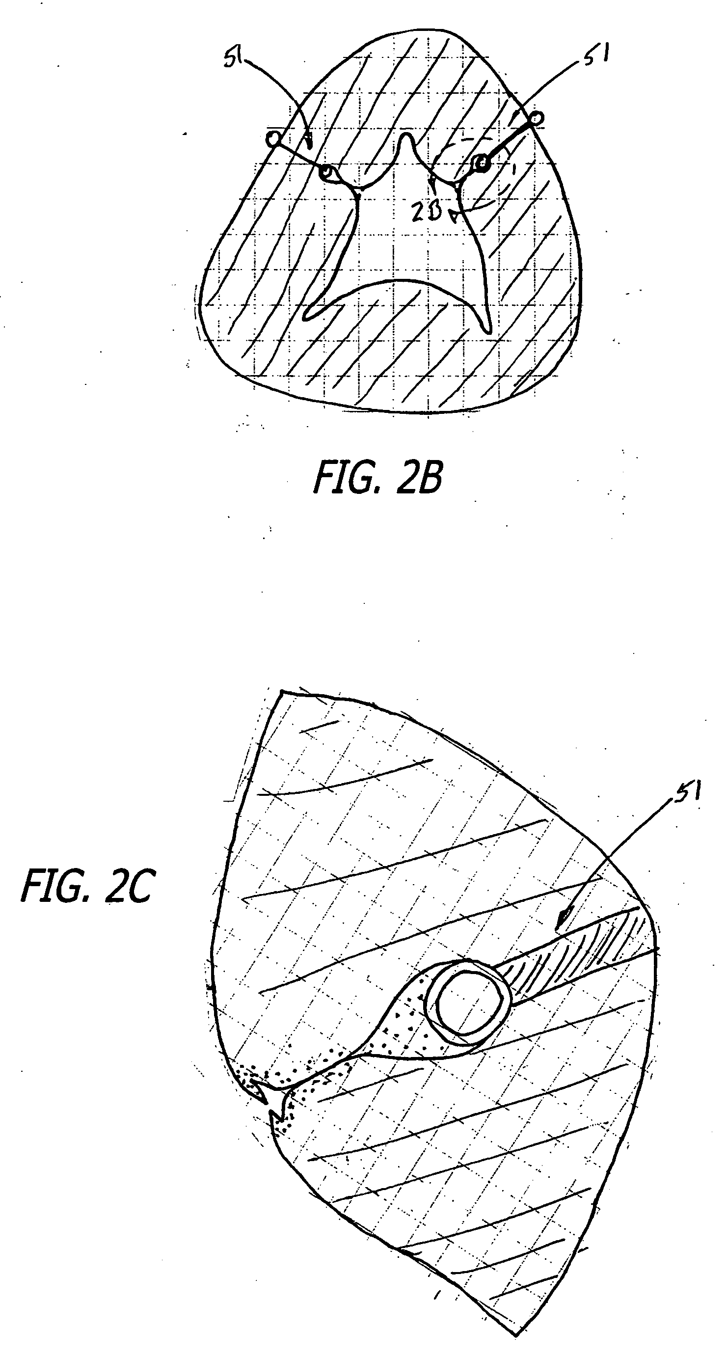 Apparatus and method for manipulating or retracting tissue and anatomical structure