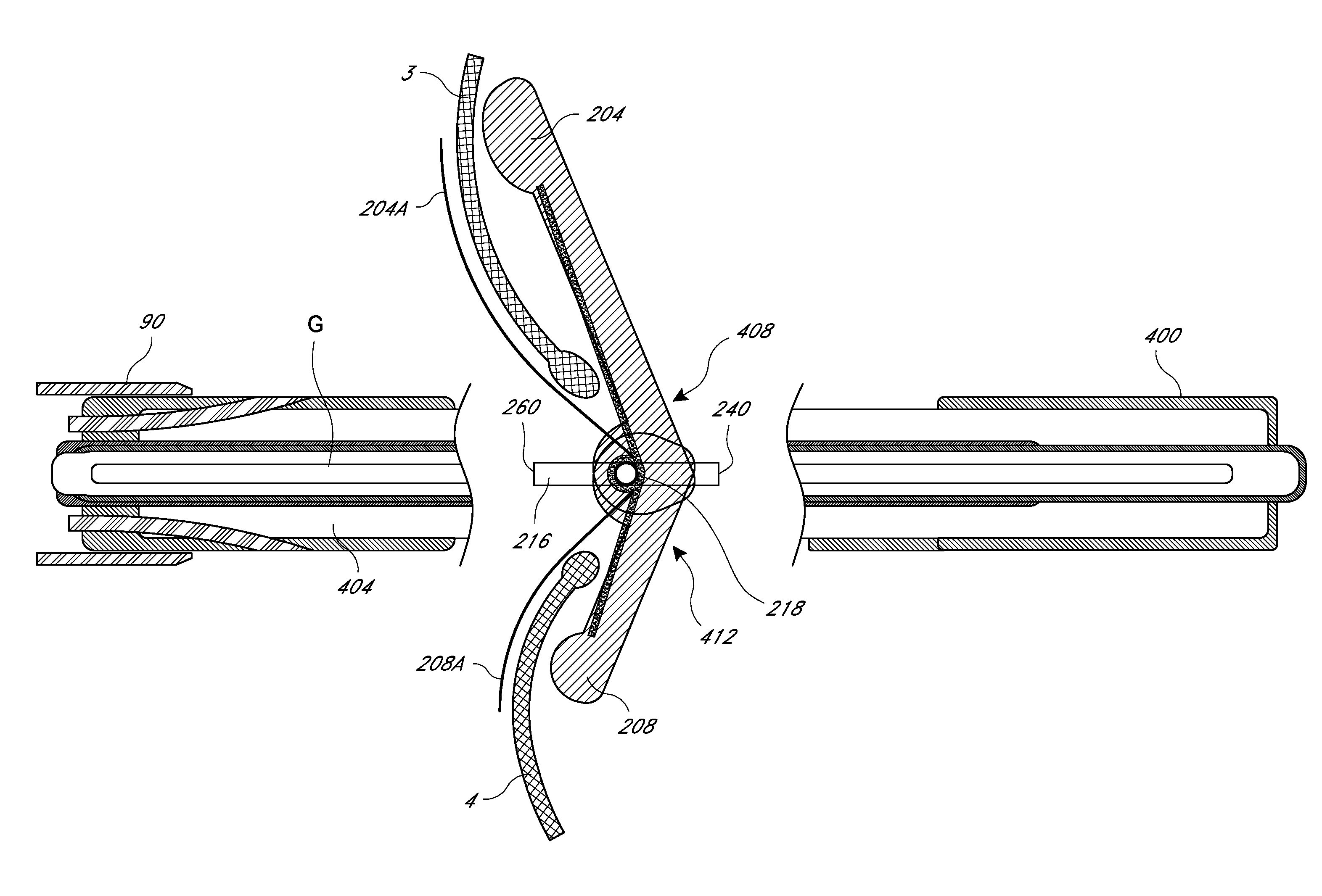 Method and apparatus for percutaneous delivery and deployment of a cardiovascular prosthesis