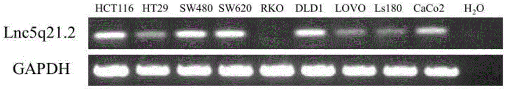 Long noncoding RNA, primer pair for detecting expression level of long noncoding RNA in cell line and tissue as well as kit