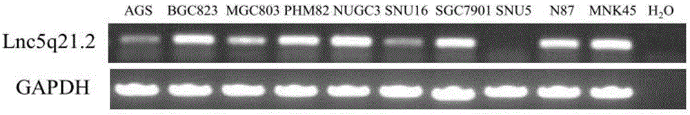 Long noncoding RNA, primer pair for detecting expression level of long noncoding RNA in cell line and tissue as well as kit