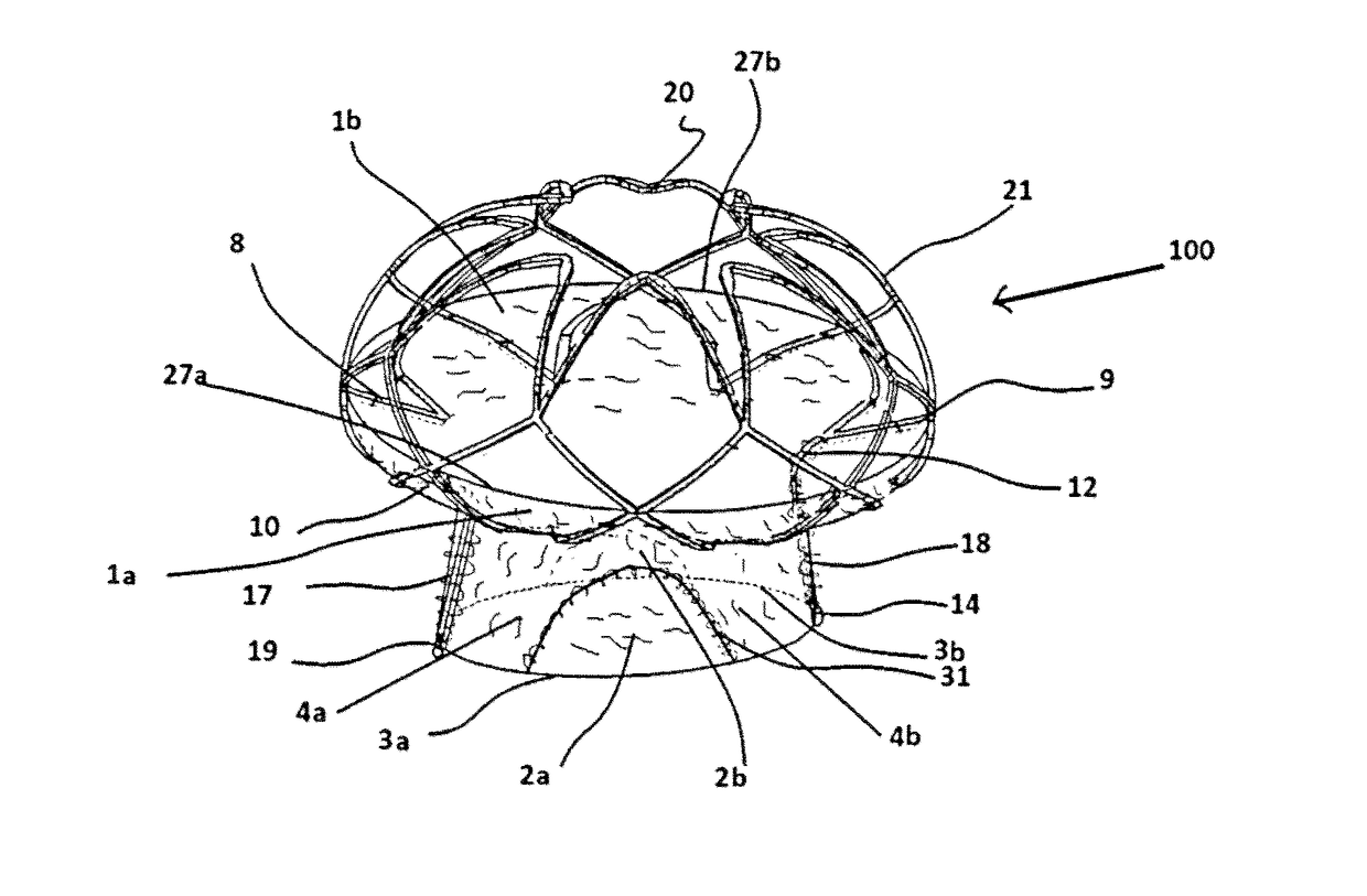 Mitral Valve Assembly