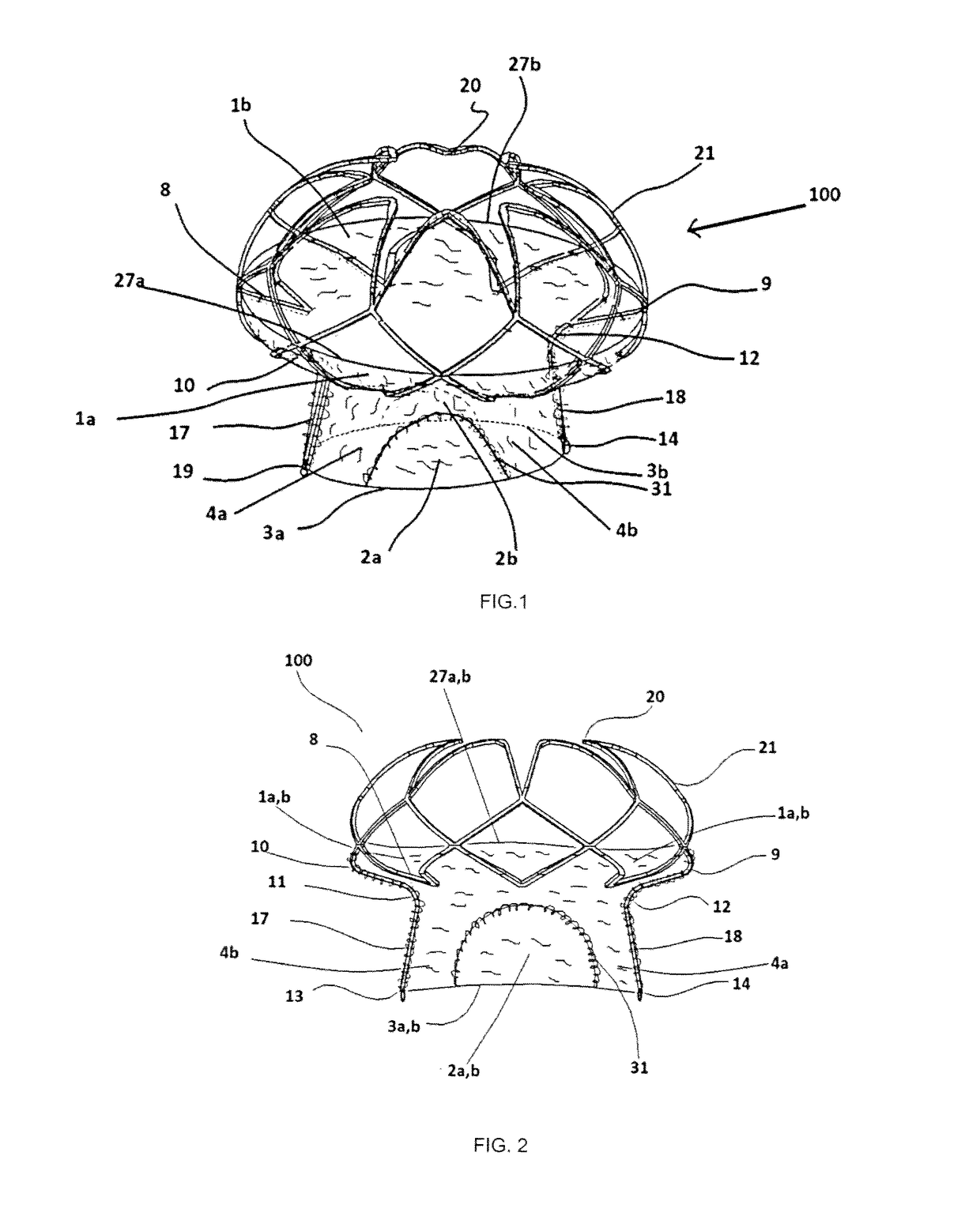 Mitral Valve Assembly