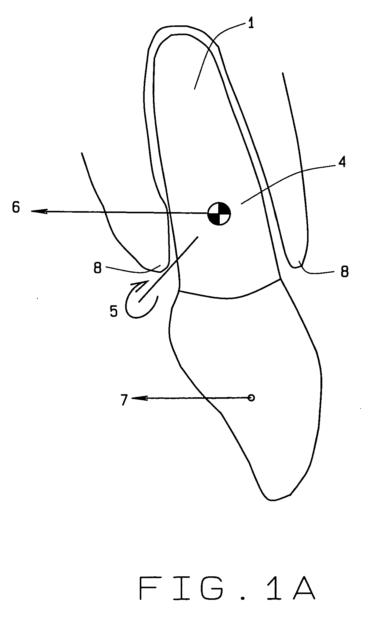System and method for improved control of tooth movement with elastic repositioning appliances