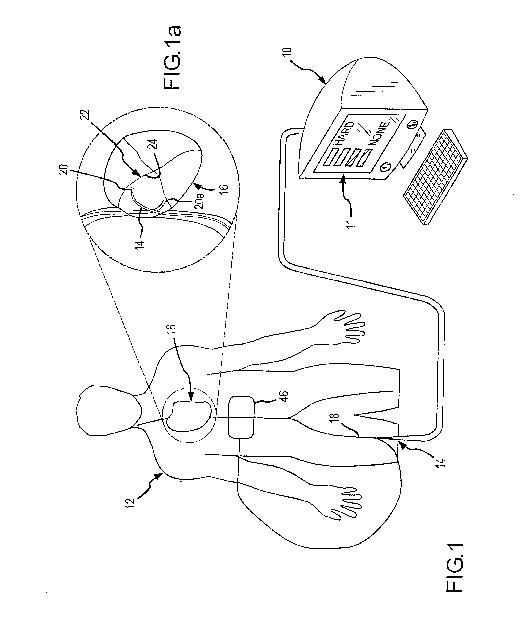 Assessment of electrode coupling for tissue ablation