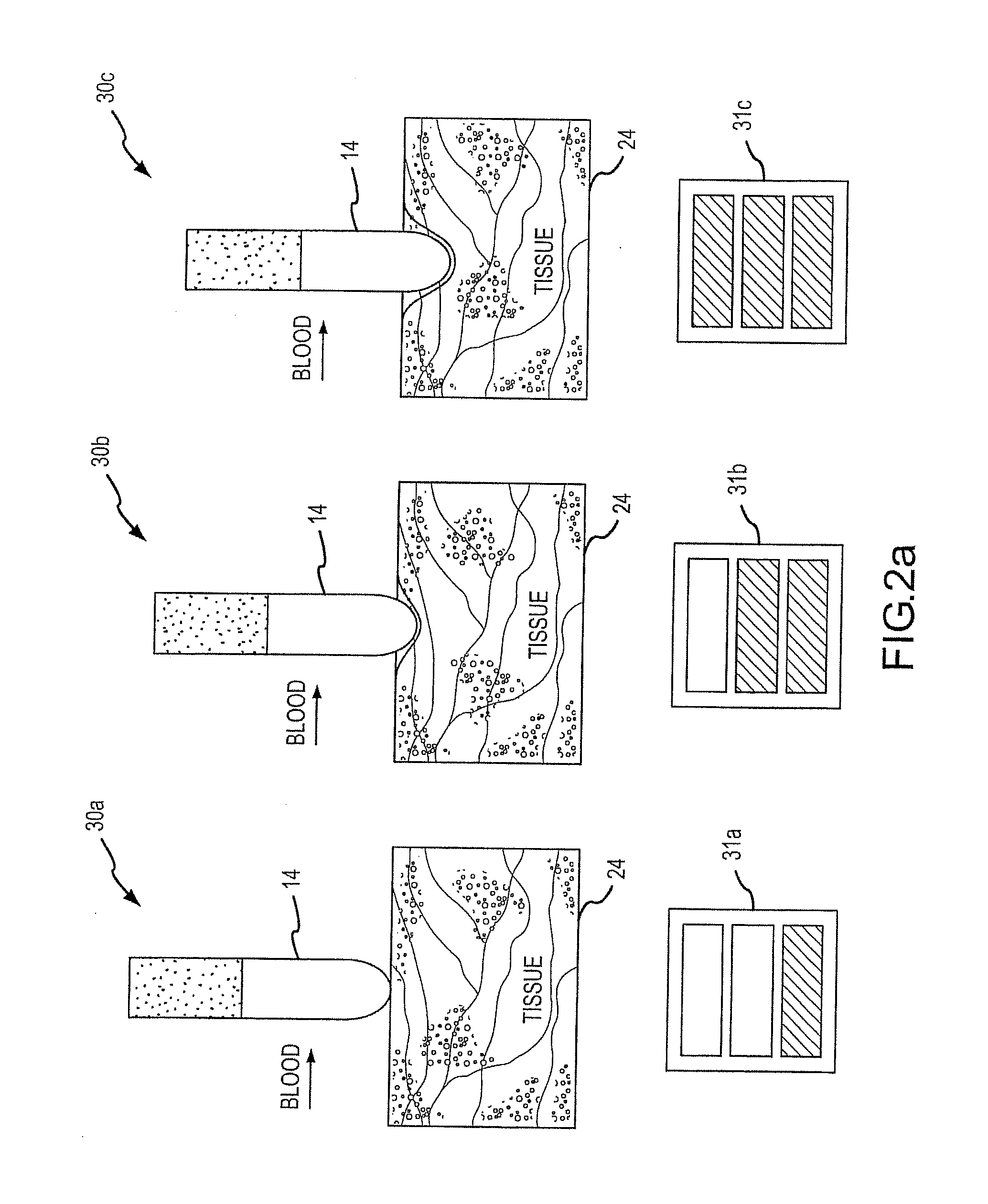 Assessment of electrode coupling for tissue ablation