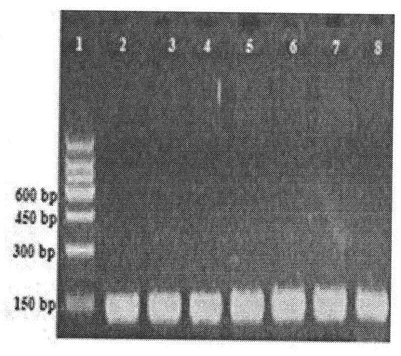 Method for effectively and quickly detecting high reproductive trait of sheep through BMP15 gene