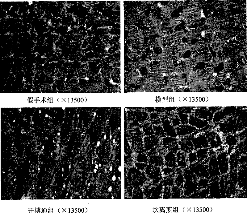 Anti-heart failure pharmaceutical composition for improving skeletal muscle function and preparation method thereof