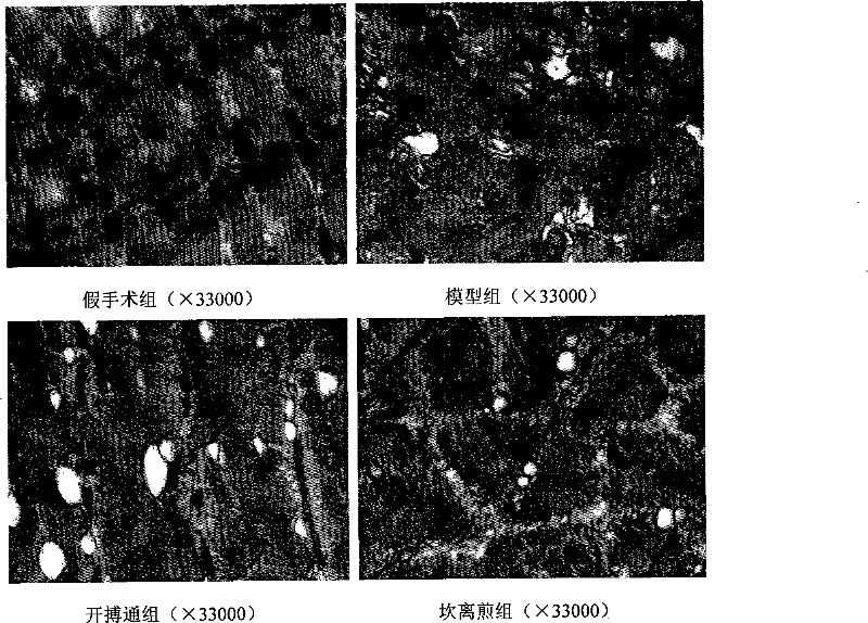 Anti-heart failure pharmaceutical composition for improving skeletal muscle function and preparation method thereof