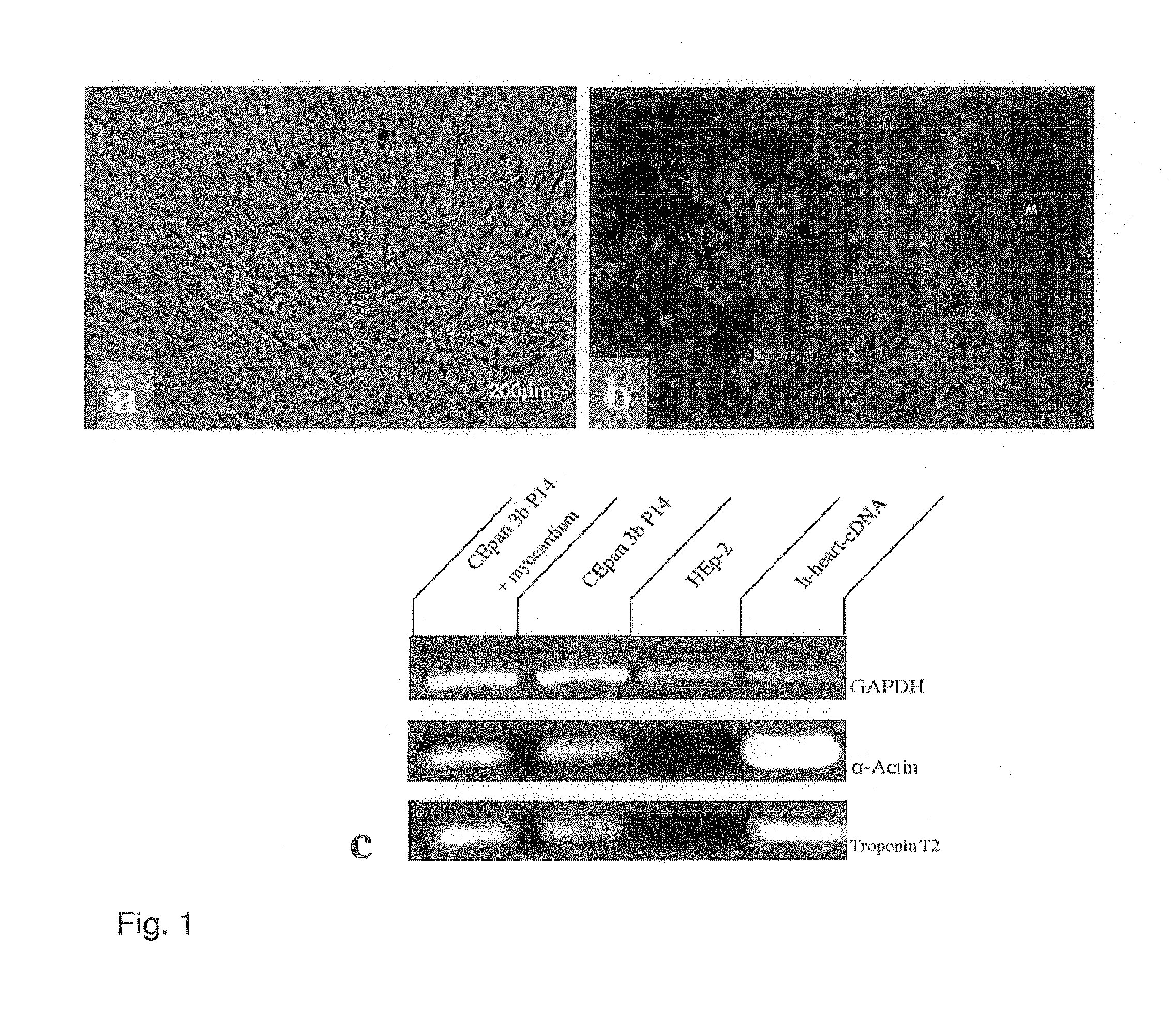 Method for producing autonomously contracting cardiac muscle cells from adult stem cells, in particular human adult stem cells
