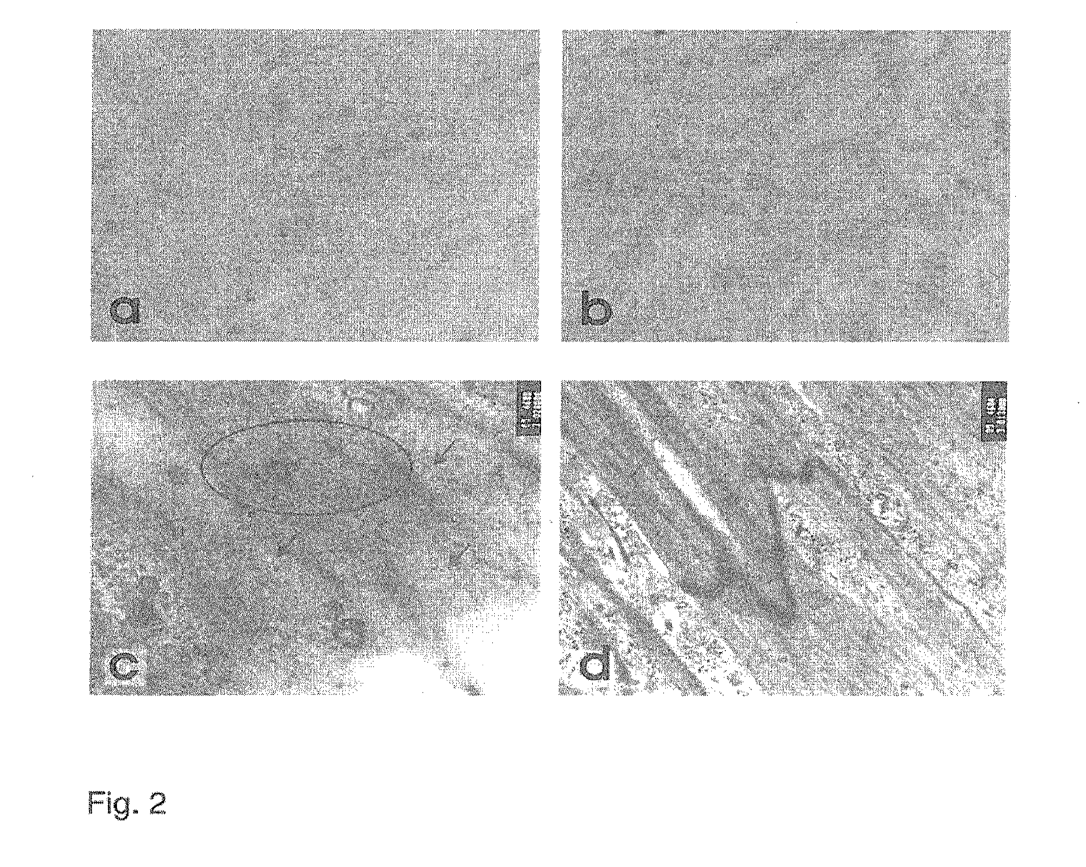 Method for producing autonomously contracting cardiac muscle cells from adult stem cells, in particular human adult stem cells