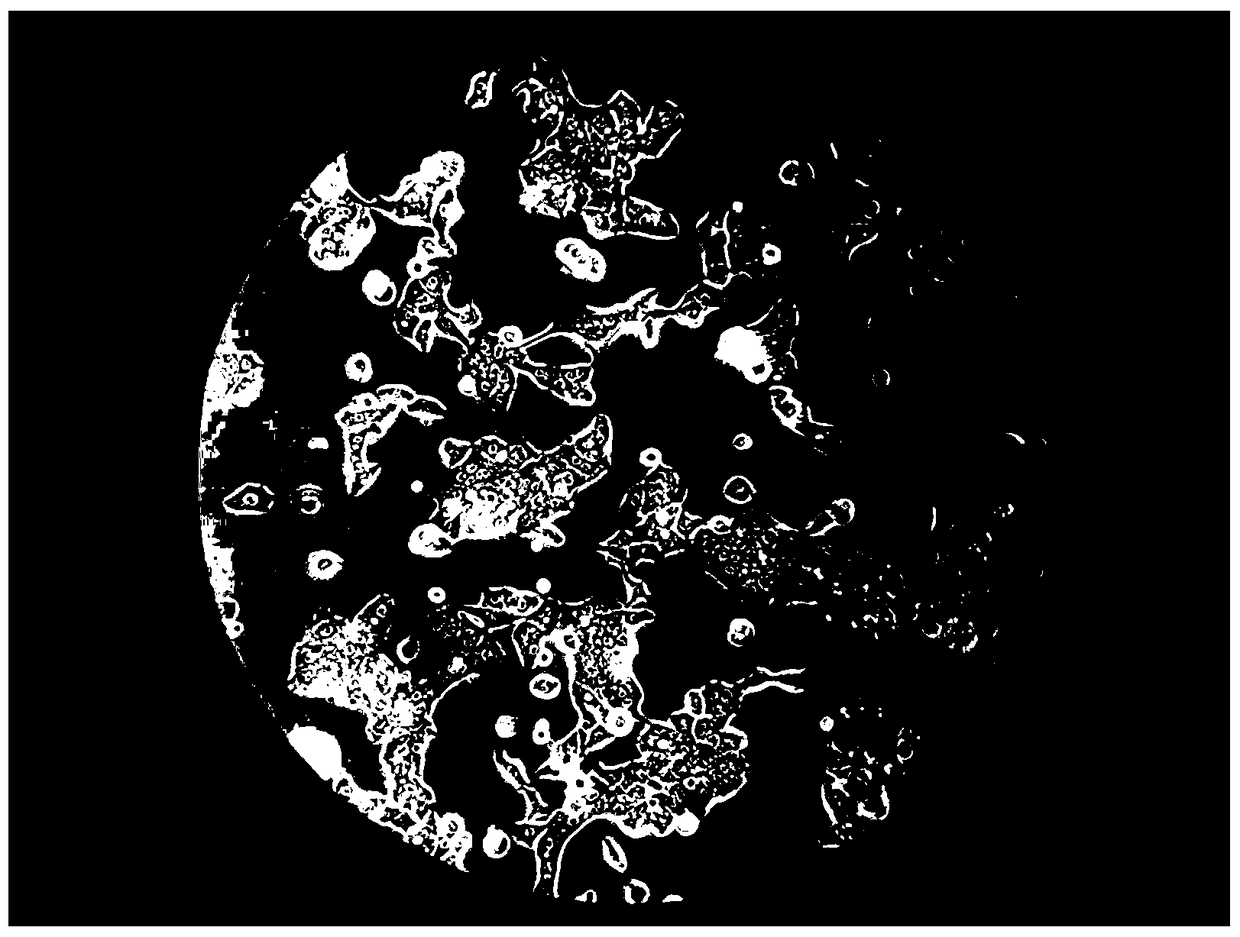 A human colon cancer cell line dxh-1 and its application