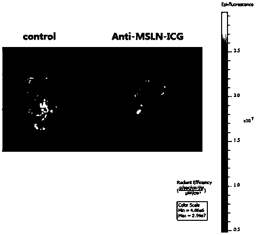 MSLN (Mesothelin) specific fluorescent probe and application thereof