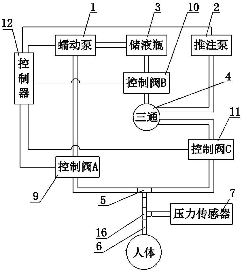 Automatic filling device used for urodynamic detection