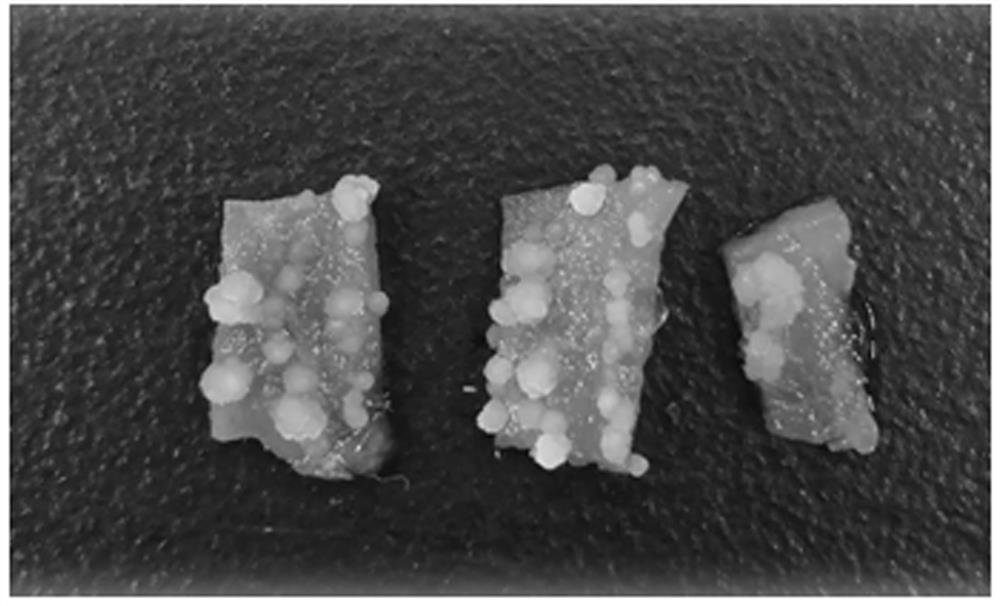 A culture method for inducing callus of Rosa roxburghii fruit and promoting the accumulation of its active substances