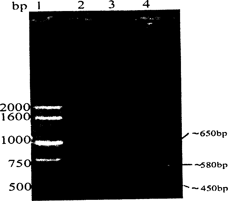 Method for producing blood vessel diseases gene medicine-blood vessel endothelium growth gene-2 naked DNA by microorganism cloning vehicle