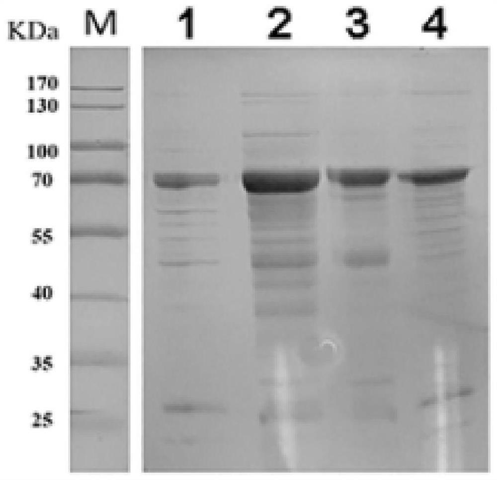 Algal toxin degrading enzyme as well as composite material and application