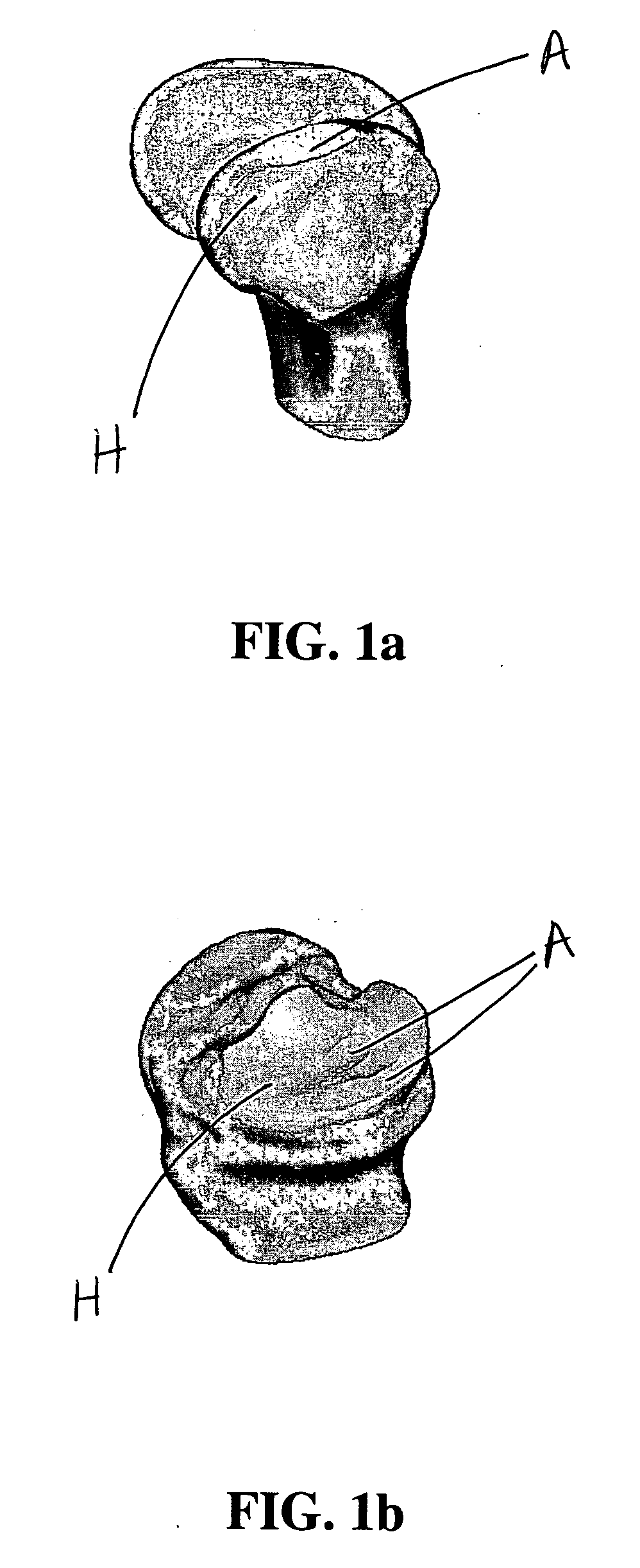 Method and system for joint repair