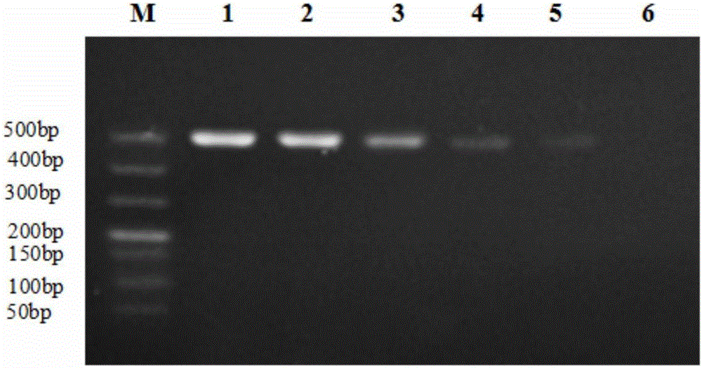 Duck plague and escherichia coli dual PCR diagnostic kit