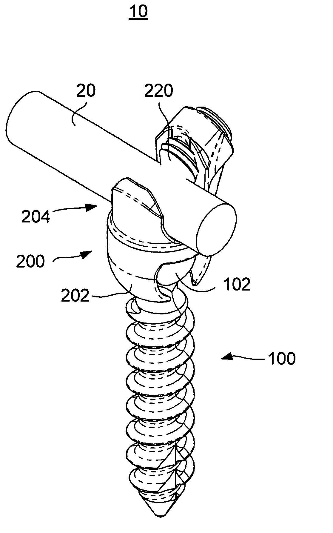 Spinal stabilization using bone anchor and anchor seat with tangential locking feature
