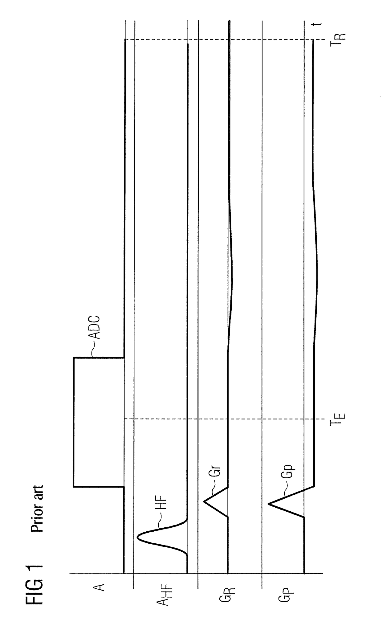 Method and apparatus for sectional optimization of radial mr pulse sequences