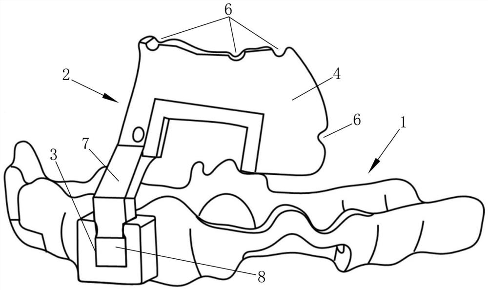 Position and direction positioning guide plate of periosteal nail in GBR and manufacturing method thereof