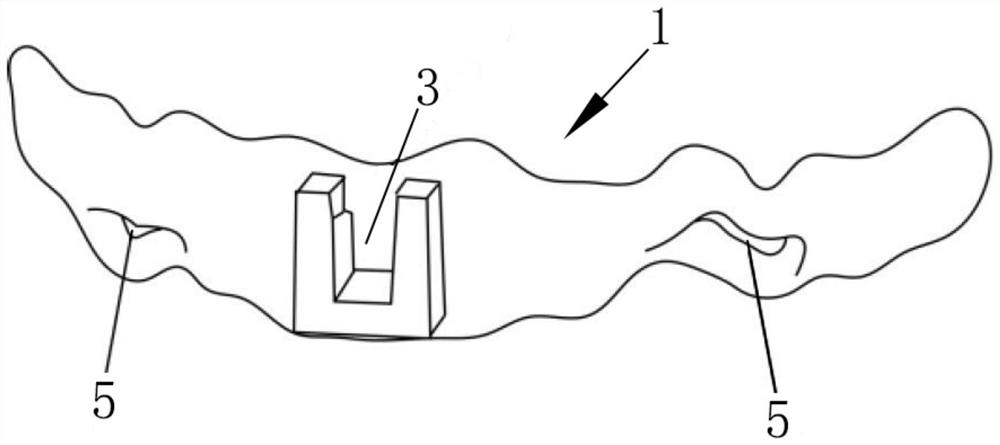 Position and direction positioning guide plate of periosteal nail in GBR and manufacturing method thereof