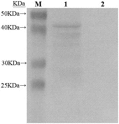 Application of Recombinant Eukaryotic Expression Plasmid Complex in Preparation of Equine Streptococcus Vaccine