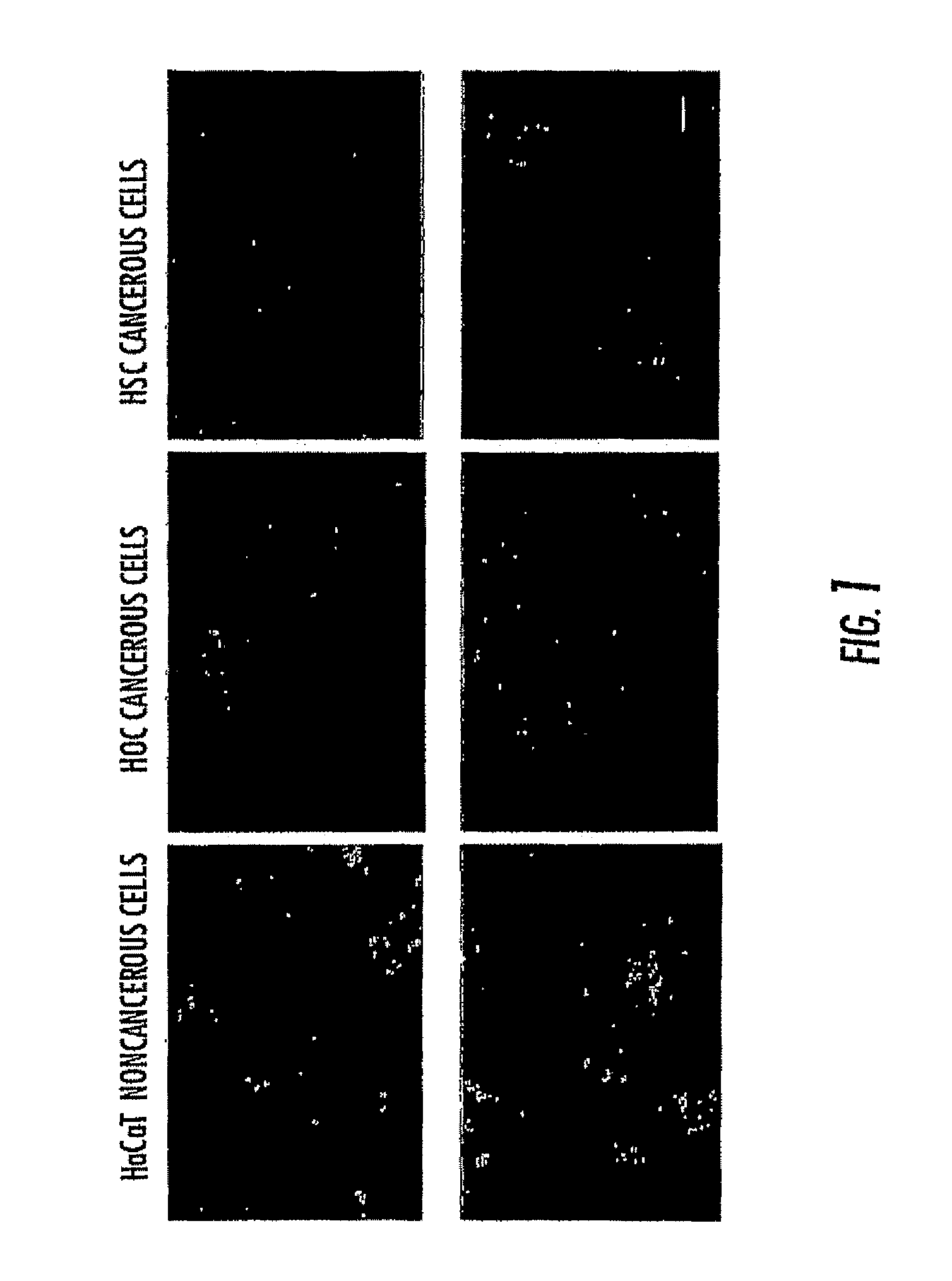 Shape tunable plasmonic nanoparticles