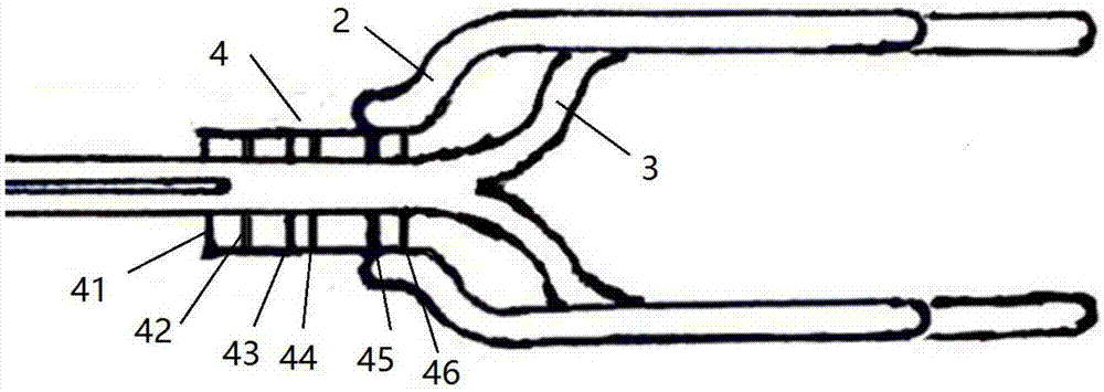 Minimally invasive collagen membrane retainer used for tissue engineering cartilage grafting