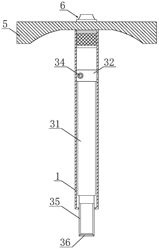 Medical orthopaedic clinical free body extractor