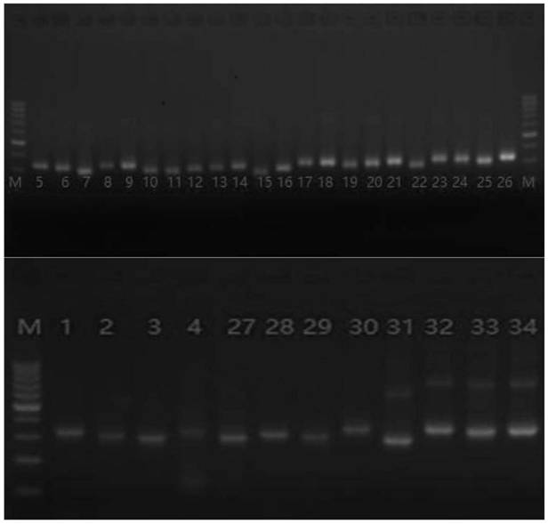 Specific primer and test kit for detecting pathogenic variation of deafness gene based on multiplex PCR and high-throughput sequencing technology and application