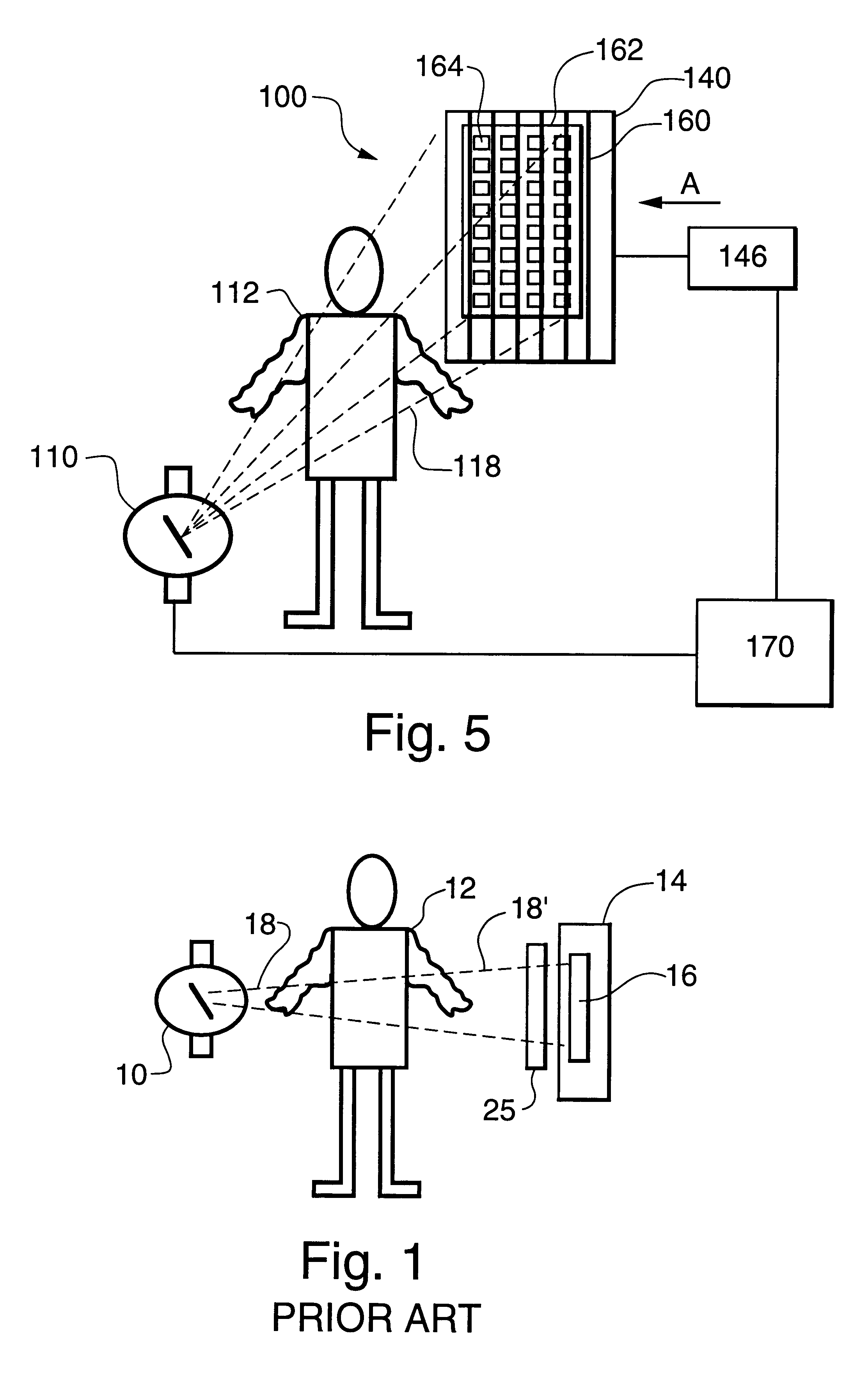 Single-stroke radiation anti-scatter device for x-ray exposure window