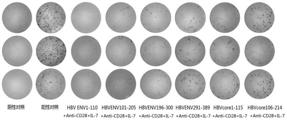 Amplification method of polyclonal anti-HBV immune cells