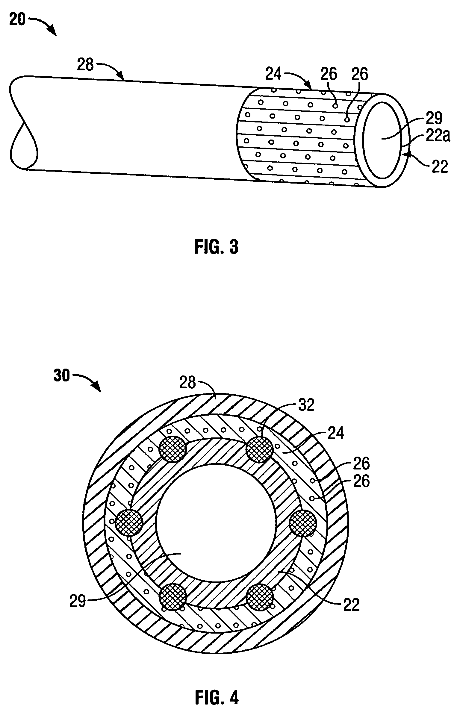 Composite vascular graft including bioactive agent coating and biodegradable sheath