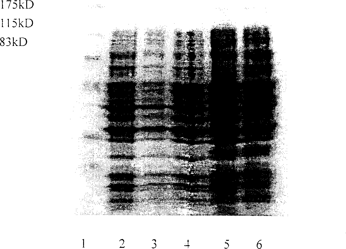Fusion anticaries DNA vaccine and prepring method thereof