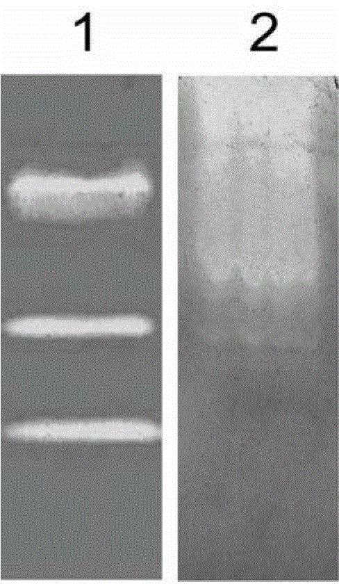 Zymogram active electrophoresis detection method