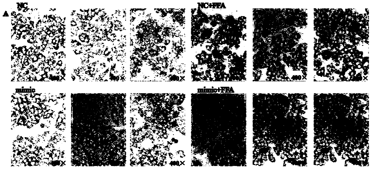 Sequence of MicroRNA used for early diagnosis of type 2 diabetes and application of sequence of microRNA used for early diagnosis of type 2 diabetes