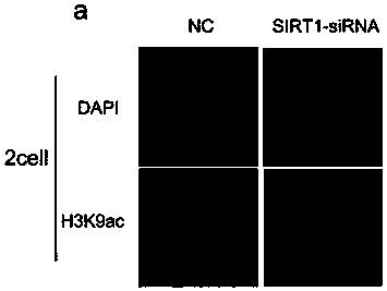 Expression inhibitor of pig SIRT1 gene and application of expression inhibitor